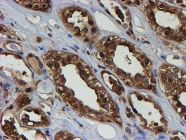 PSMB9 Antibody in Immunohistochemistry (Paraffin) (IHC (P))