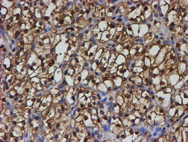 PSMB9 Antibody in Immunohistochemistry (Paraffin) (IHC (P))