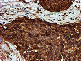 PSMB9 Antibody in Immunohistochemistry (Paraffin) (IHC (P))