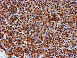 PSMB9 Antibody in Immunohistochemistry (Paraffin) (IHC (P))