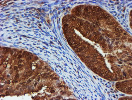 PSMB9 Antibody in Immunohistochemistry (Paraffin) (IHC (P))