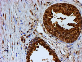 PSMB9 Antibody in Immunohistochemistry (Paraffin) (IHC (P))