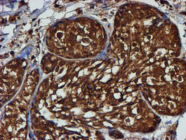 PSMB9 Antibody in Immunohistochemistry (Paraffin) (IHC (P))