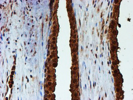 PSMB9 Antibody in Immunohistochemistry (Paraffin) (IHC (P))