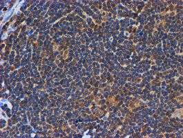 PSMB9 Antibody in Immunohistochemistry (Paraffin) (IHC (P))