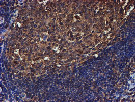 PSMB9 Antibody in Immunohistochemistry (Paraffin) (IHC (P))