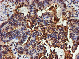 PSMB9 Antibody in Immunohistochemistry (Paraffin) (IHC (P))