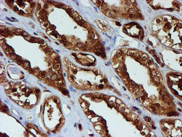 PSMB9 Antibody in Immunohistochemistry (Paraffin) (IHC (P))