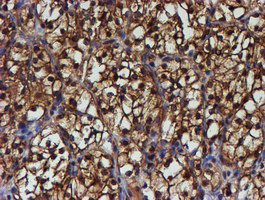 PSMB9 Antibody in Immunohistochemistry (Paraffin) (IHC (P))