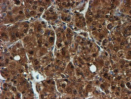 PSMB9 Antibody in Immunohistochemistry (Paraffin) (IHC (P))