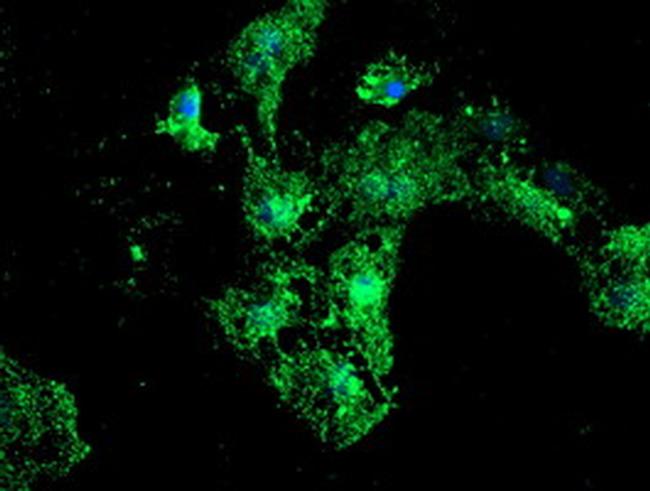 PSMB9 Antibody in Western Blot (WB)