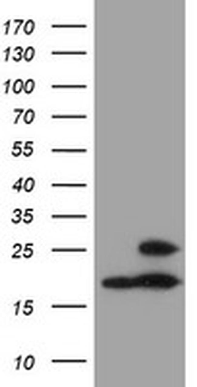 PSMB9 Antibody in Western Blot (WB)