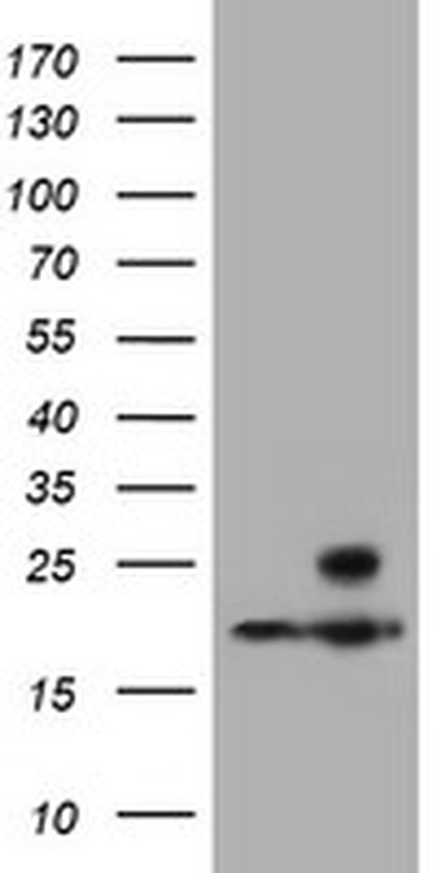 PSMB9 Antibody in Western Blot (WB)