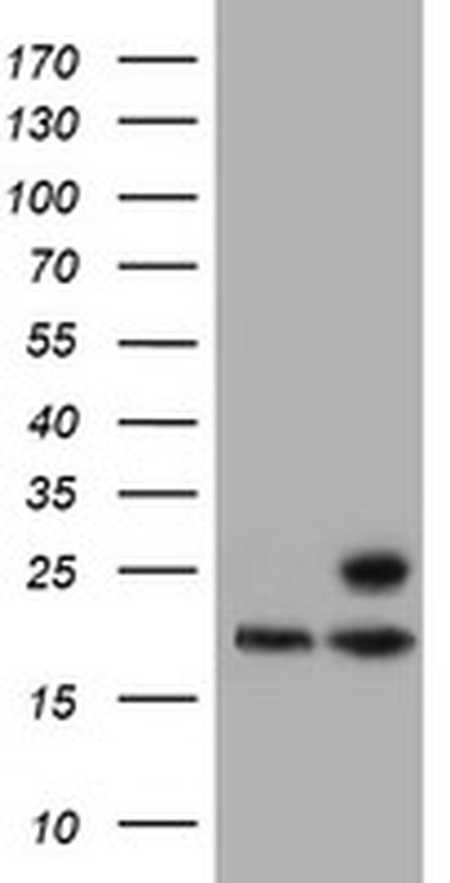 PSMB9 Antibody in Western Blot (WB)