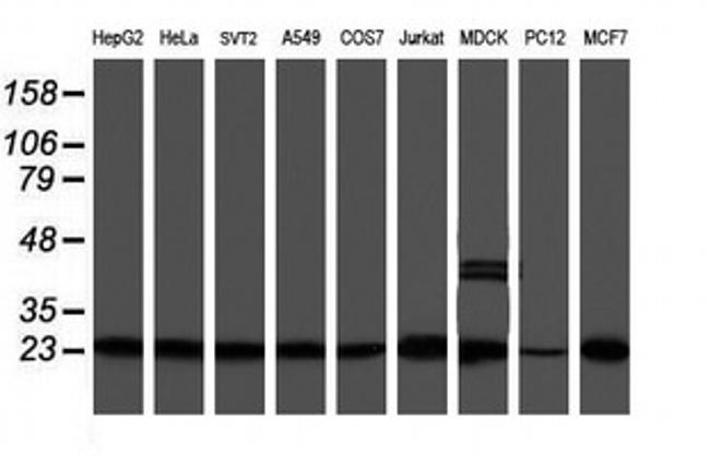 PSMB9 Antibody in Western Blot (WB)