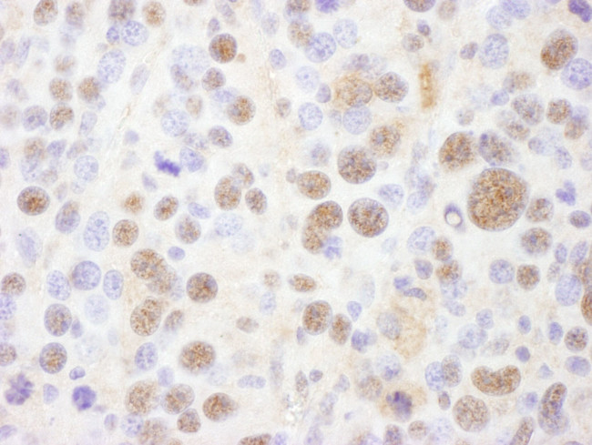 PSMC1 Antibody in Immunohistochemistry (IHC)