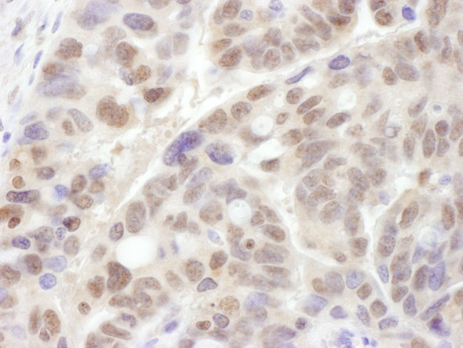 PSMC1 Antibody in Immunohistochemistry (IHC)