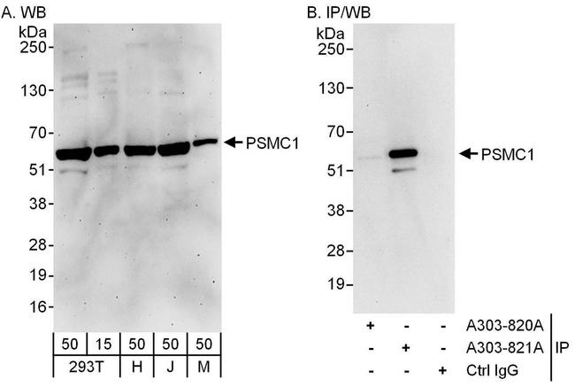 PSMC1 Antibody in Western Blot (WB)