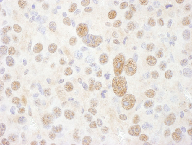 PSMC2 Antibody in Immunohistochemistry (IHC)