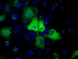 PSMC3 Antibody in Immunocytochemistry (ICC/IF)