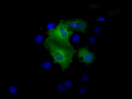 PSMC3 Antibody in Immunocytochemistry (ICC/IF)