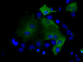 PSMC3 Antibody in Immunocytochemistry (ICC/IF)