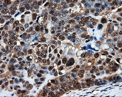 PSMC3 Antibody in Immunohistochemistry (Paraffin) (IHC (P))