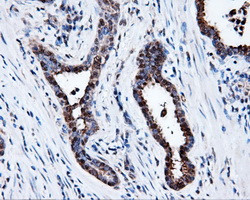 PSMC3 Antibody in Immunohistochemistry (Paraffin) (IHC (P))