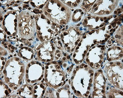 PSMC3 Antibody in Immunohistochemistry (Paraffin) (IHC (P))