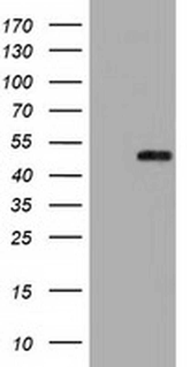 PSMC3 Antibody in Western Blot (WB)