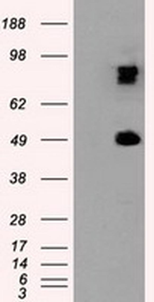 PSMC3 Antibody in Western Blot (WB)