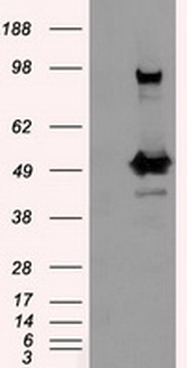 PSMC3 Antibody in Western Blot (WB)