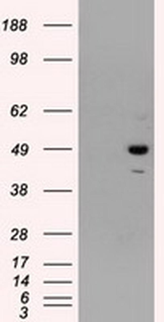 PSMC3 Antibody in Western Blot (WB)