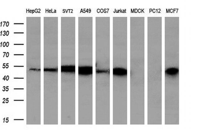 PSMC3 Antibody in Western Blot (WB)