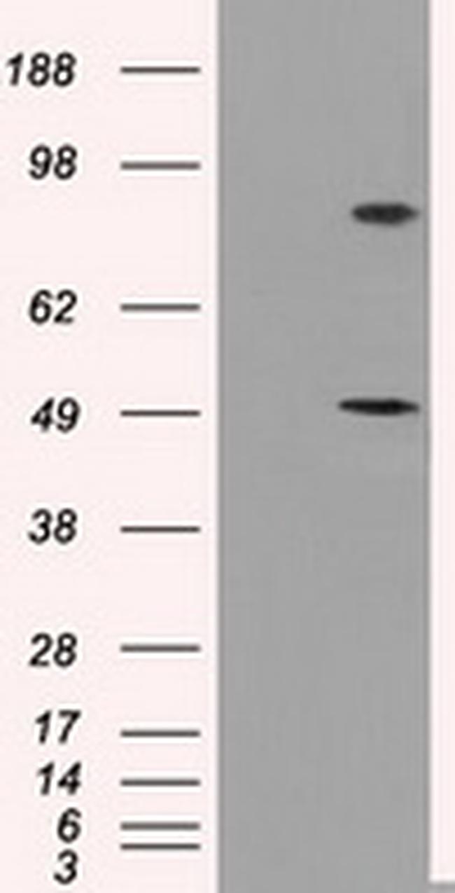 PSMC3 Antibody in Western Blot (WB)