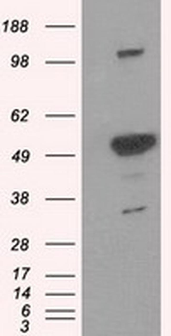 PSMC3 Antibody in Western Blot (WB)