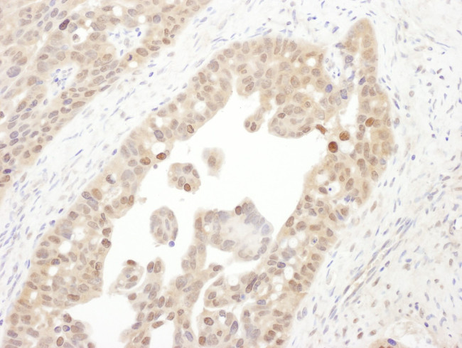 PSMC4 Antibody in Immunohistochemistry (IHC)