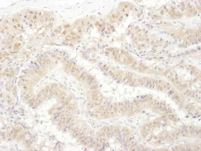 PSMC4 Antibody in Immunohistochemistry (IHC)