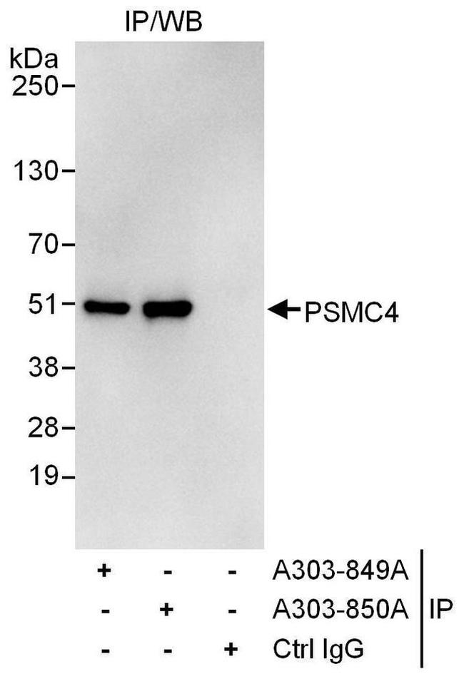 PSMC4 Antibody in Western Blot (WB)