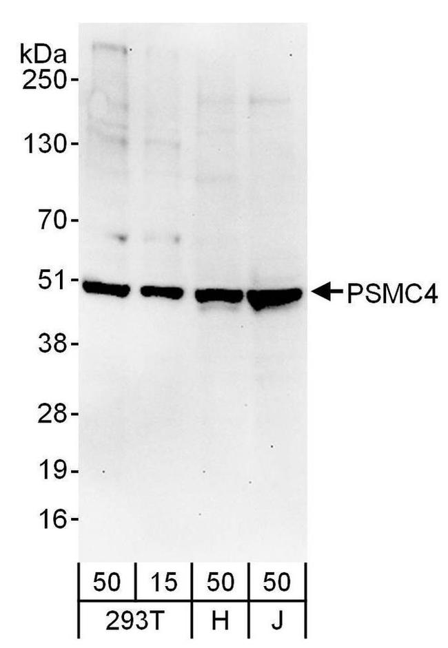 PSMC4 Antibody in Western Blot (WB)