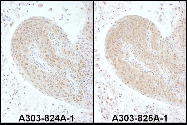 PSMC6 Antibody in Immunohistochemistry (IHC)