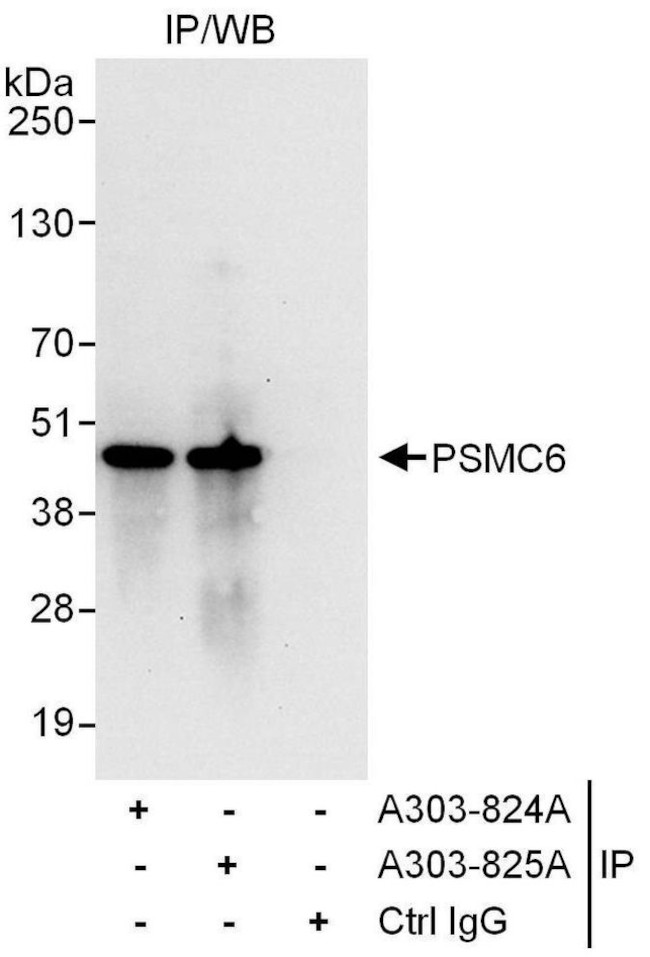 PSMC6 Antibody in Immunoprecipitation (IP)