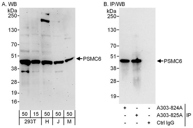 PSMC6 Antibody in Western Blot (WB)