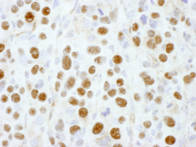 PSMD1 Antibody in Immunohistochemistry (IHC)