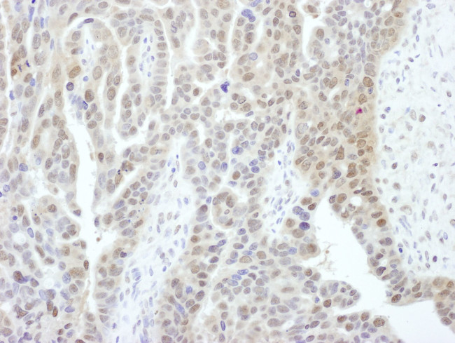 PSMD1 Antibody in Immunohistochemistry (IHC)