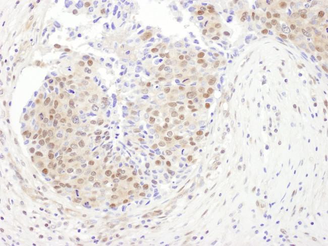 PSMD1 Antibody in Immunohistochemistry (IHC)