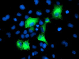 PSMD2 Antibody in Immunocytochemistry (ICC/IF)