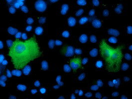 PSMD2 Antibody in Immunocytochemistry (ICC/IF)