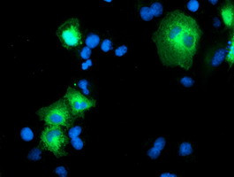 PSMD2 Antibody in Immunocytochemistry (ICC/IF)