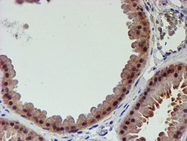 PSMD2 Antibody in Immunohistochemistry (Paraffin) (IHC (P))